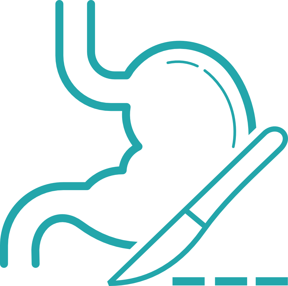 Best Gastro Surgery Hospital in India 