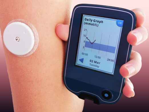 1.-continuous-glucose-monitoring-cgm.png