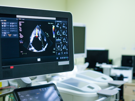 2.-echocardiogram.png