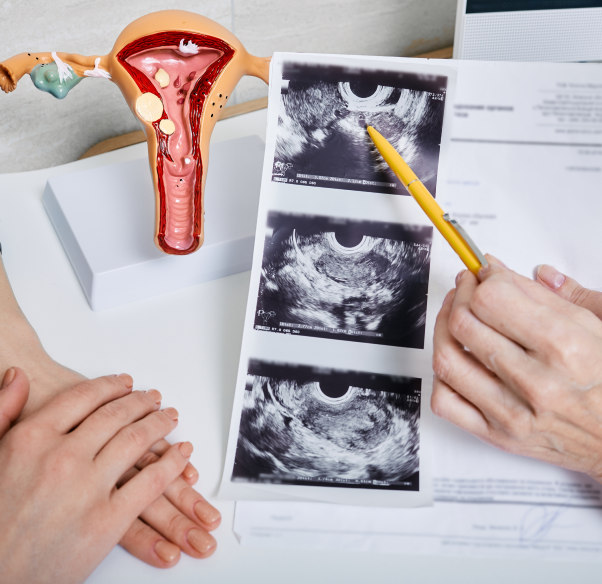 gynaecology-condition-treated.png