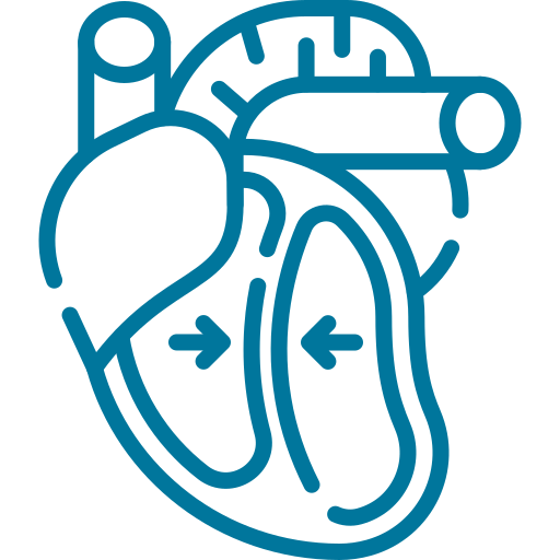 Cardiomyopathy