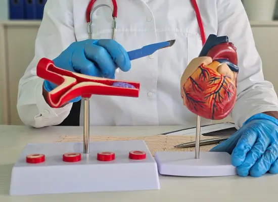 What is CABG Surgery?