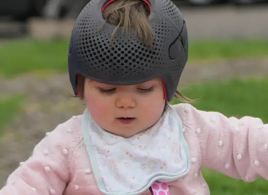 Types of Craniosynostosis Surgery