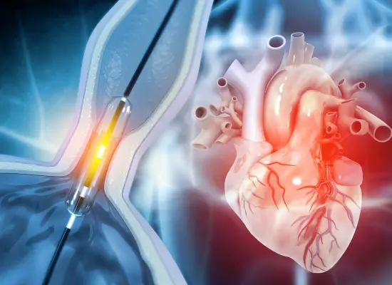 What is Digital Subtraction Angiography?