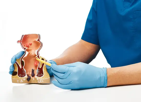 Causes Of Anal Fissure