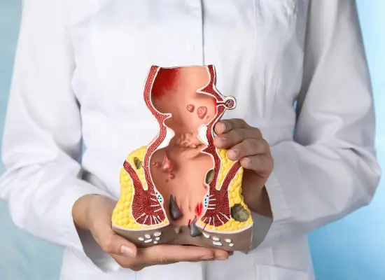 What Causes an Anal Fistula?