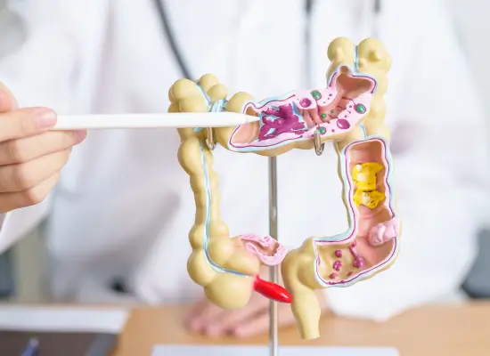 Types Of Irritable Bowel Syndrome