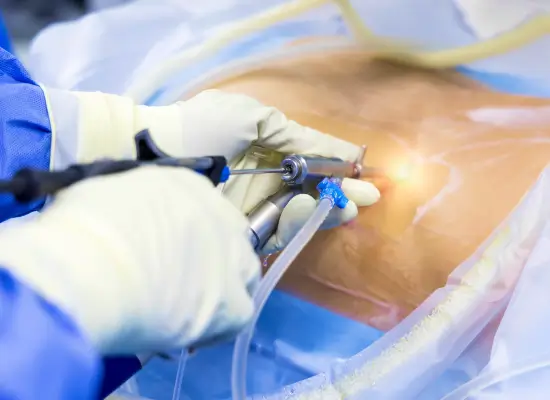 Conditions Treated with Keyhole Spine Surgery
