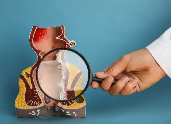 Procedure of Laser Fistula