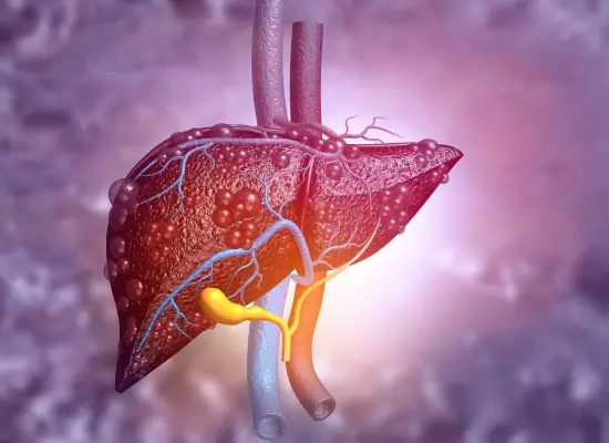 Types of Robotic Liver Surgery