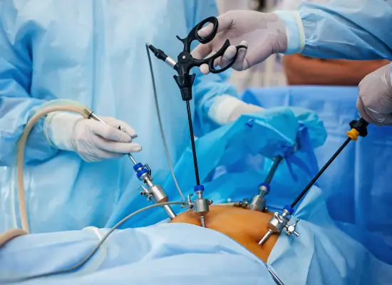 Different Types Of Cholecystectomy Procedures