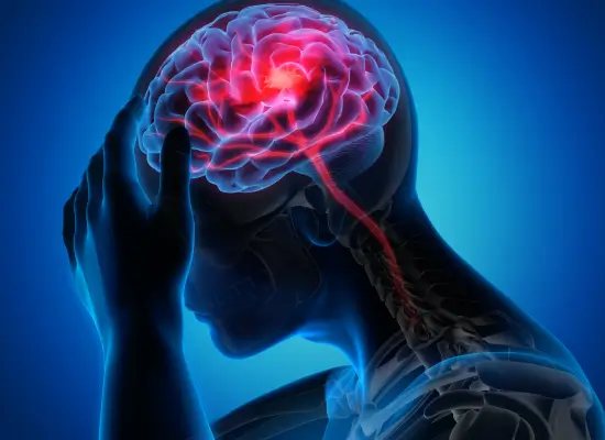 Types of Stroke