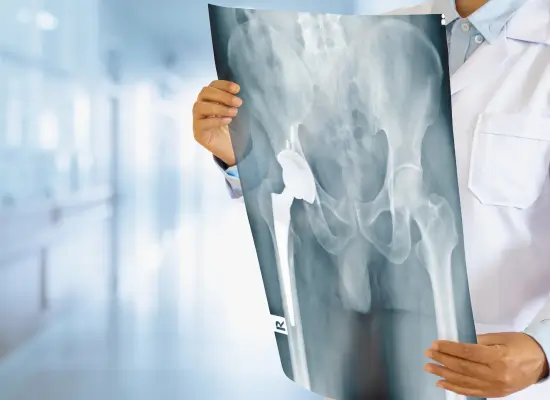 Conditions Treated with Total Hip Replacement